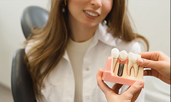 Dental implants