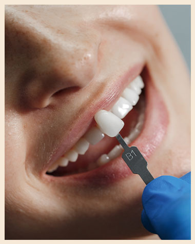 Main treatment - Dental Implants